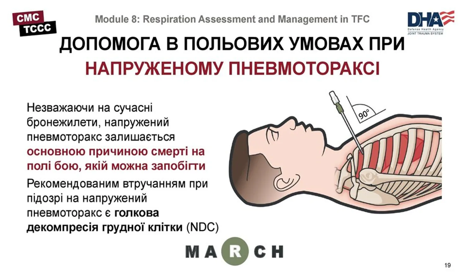 CMC TCCC, Module 8 — «ДОПОМОГА В ПОЛЬОВИХ УМОВАХ ПРИ НАПРУЖЕНОМУ ПНЕВМОТОРАКСІ». Попри сучасні бронежилети, напружений…