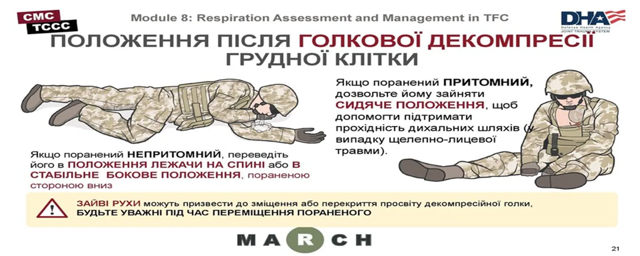 CMC TCCC, Module 8: Respiration Assessment and Management in TFC — «ПОЛОЖЕННЯ ПІСЛЯ ГОЛКОВОЇ ДЕКОМПРЕСІЇ ГРУДНОЇ…